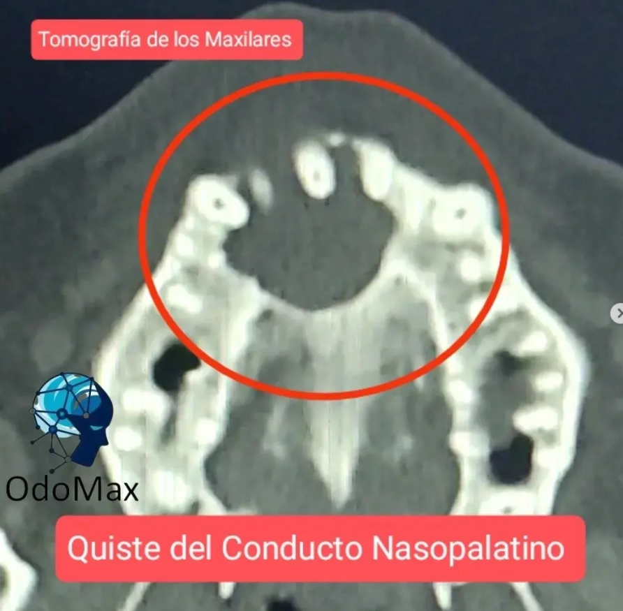 caso 1.1