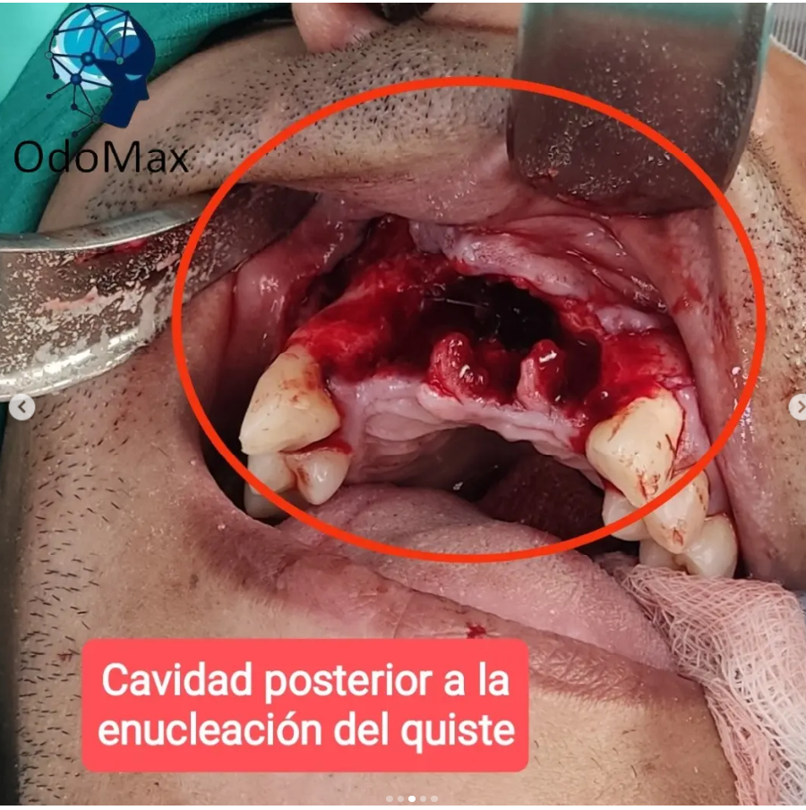 caso 1.3